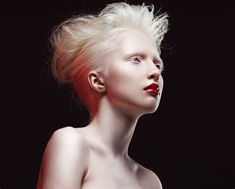 Albino On Behance Albino Model Albino Human Albino Girl