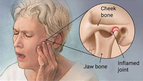 Physical Symptoms Of Anxiety Jaw Pain Qhysic