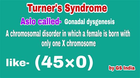 Turner Syndrome Causes Types Of The Turner Gs India Nursing Academy