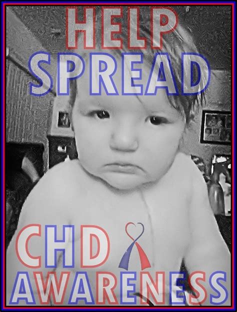 My Chd Daughter Annabelle ️💔 Chd Awareness Chd Awareness