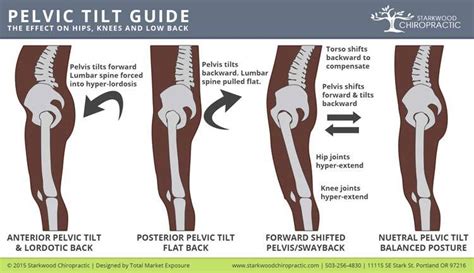 Fixing Posterior Pelvic Tilt Hip Tilt Causes And Fixes