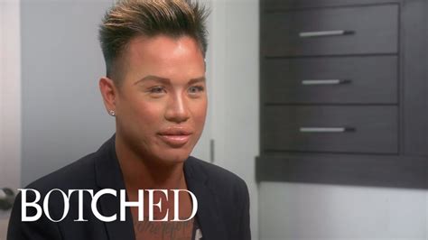 botched patient is obsessed with big doll like lips e youtube