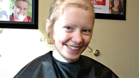 Teenager Who Pulled Out Her Hair While Battling Depression Wins First