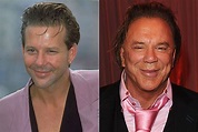 Mickey Rourke Plastic Surgery Pictures