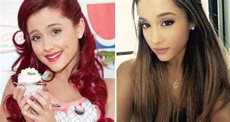Celebrity Plastic Surgery Ariana Grande Plastic Surgery Before And