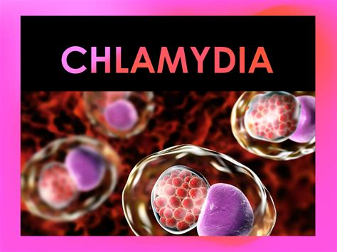Chlamydia Pulse Clinic Asias Leading Sexual Healthcare Network