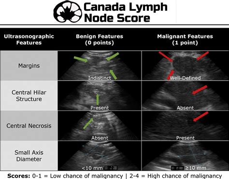 Endobronchial Ultrasound Staging Of Operable Non Small Cell Lung Cancer