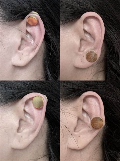 Keloid Pressure Earring Keloid Compression Earring Clip On Etsy