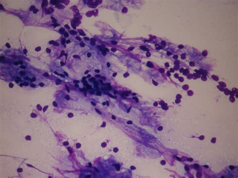 Eurocytology