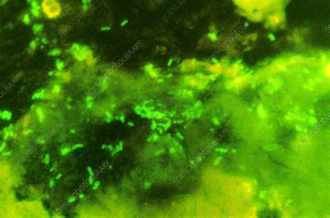 E Coli Bacteria Light Micrograph Stock Image B2300258 Science