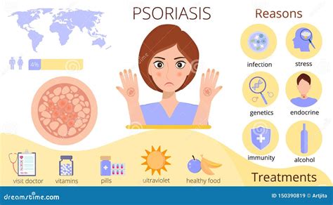 Infographics Of Psoriasis Reasons And Treatments Stock Illustration