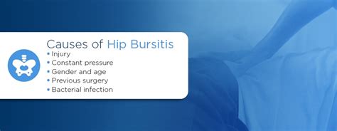 Bursitis Hip Pain Location Chart