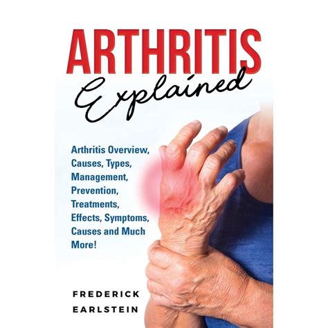 Arthritis Explained Arthritis Overview Causes Types Management