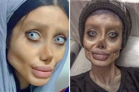 Girl Who Underwent Surgery To Look Like Angelina Jolie Was All Just