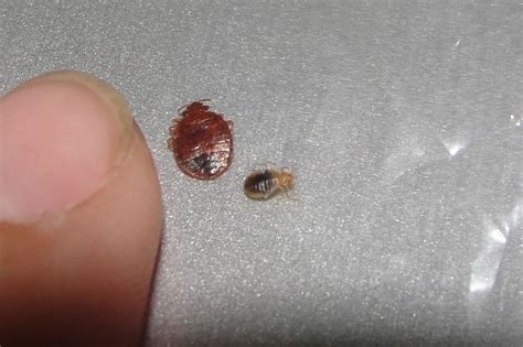 Pin By Forklifttrain On Bed Bug Bites Bed Bug Bites Bed Bugs Bed