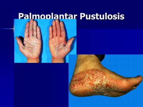 Ppt Andrews Diseases Of The Skin Chapter 10 Pg 239 253 And Chapter 11