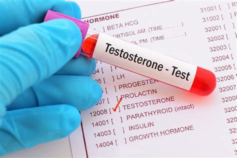 What Is Testosterone Serum Female Lab Results Explained