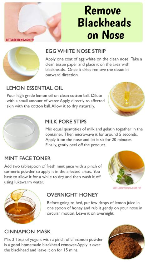 Amazing Natural Ways To Get Rid Of Blackheads On Nose The Indian Spot