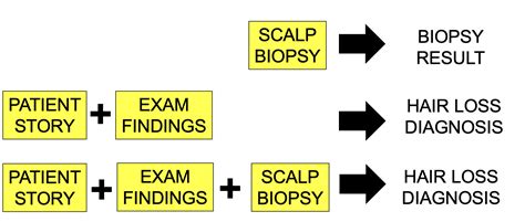 Scalp Biopsies Lead To Scalp Biopsy Results Not Final Diagnoses