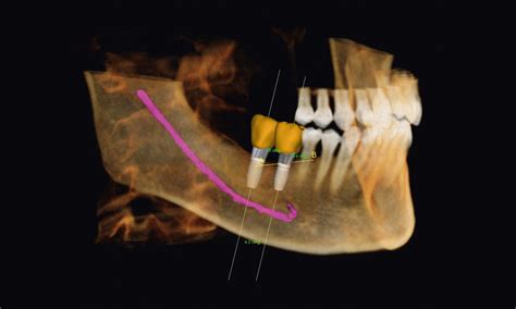 Cbct Scans Dental Scan Ltd