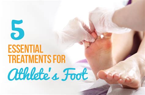 5 Essential Treatments For Athletes Foot