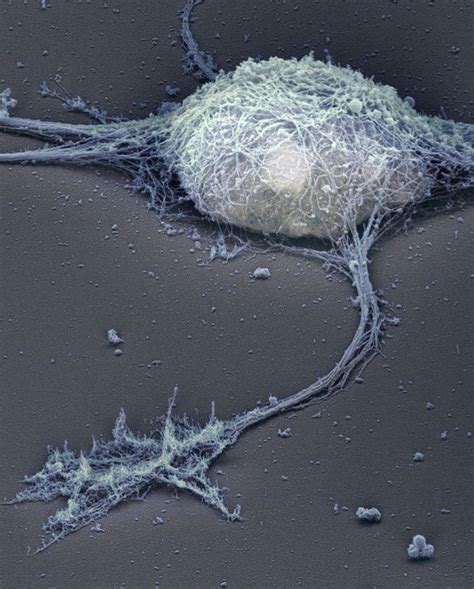 Neurônio Ao Microscópio Electron Microscope Microscopic Photography
