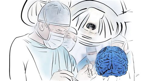 This Article Includes New Research On Migraine Surgery What Surgery To