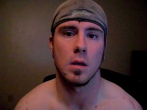 Once the tattoo is a month. Keloids and tattoos - YouTube