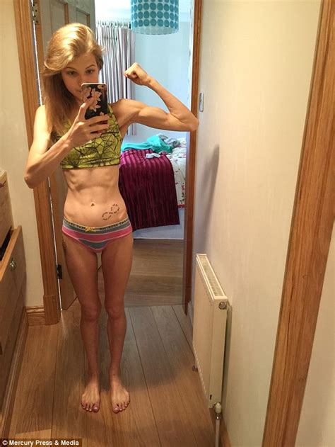Anorexic Whose Weight Plummeted To FIVE STONE Turned Life Around To Become Bodybuilding Champion