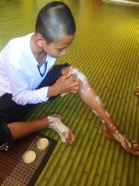 Vitamin e sangat baik untuk kulit fungsinya khusus untuk membuat kulit terhidrasi. Wansteddy Tales: Krim & Sabun Mutiara Bumi rawatan untuk ...