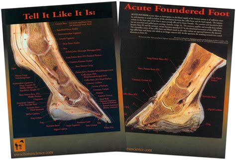 Normal And Foundered Hoof Chart Set