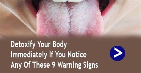 Detoxify Your Body Immediately If You Notice Any Of These 9 Warning Signs Health Recipes Article