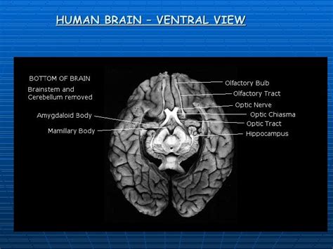 Human Brain Ventral View