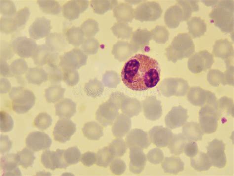 Eosinophil Cell Stock Photo Image Of Anemia Platelet 99629362