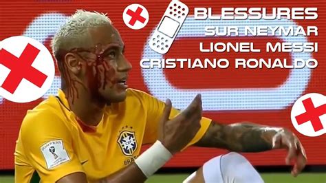 Blessures Sur Neymar Lionel Messi Cristiano Ronaldo Youtube