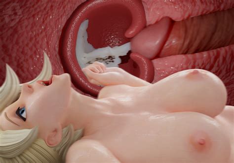 Factores De Riesgo De La Hiperplasia Endometrial Hot Sex Picture