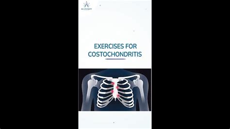 Exercises For Costochondritis Chest Wall Pain Syndrome Youtube