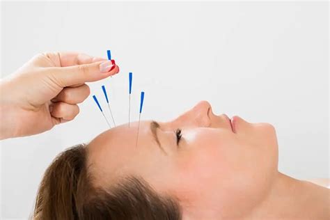 acupuncture dry needling gw osteopathy