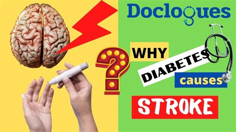 Why Diabetes Causes Stroke Youtube