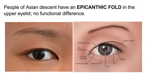 Epicanthal Folds Vs Normal Eye ~ News Word