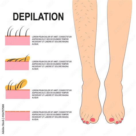 Depilation Vector Illustration Female Legs Before And After Waxing
