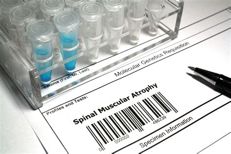 Spinal Muscular Atrophy Testing Rare Disease Advisor