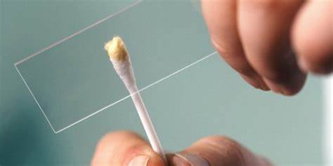 Мазок у женщин диета