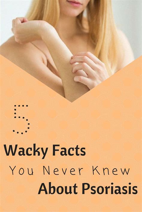 5 Wacky Facts You Never Knew About Psoriasis Psoriasis Skin