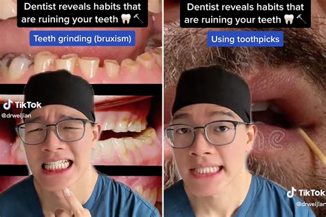 These 3 Habits Are Ruining Your Teeth According To A Dentist Today Breeze