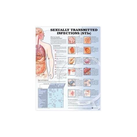 sexually transmitted infections anatomical chart laminated 20 x26