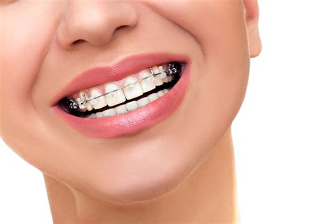 Salud Dental Ortodoncia
