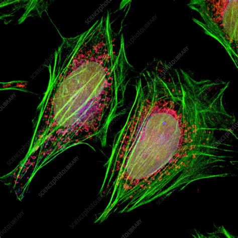 Hela Cells Light Micrograph Stock Image G4420258 Science Photo