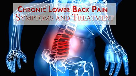 Chronic Low Back Pain Imrs Worlds Top Rated Pemf Devices In India