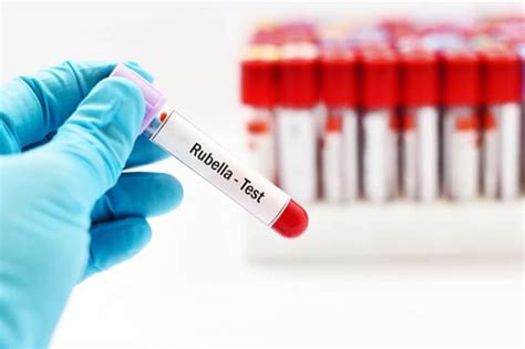 How To Read Accurate Rubella Test Diag